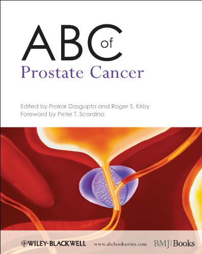ABC of Prostate Cancer Main image