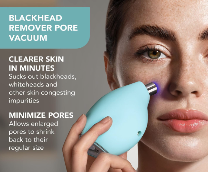 Foreo Blackhead Removal Vacuum