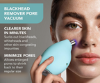 Foreo Blackhead Removal Vacuum