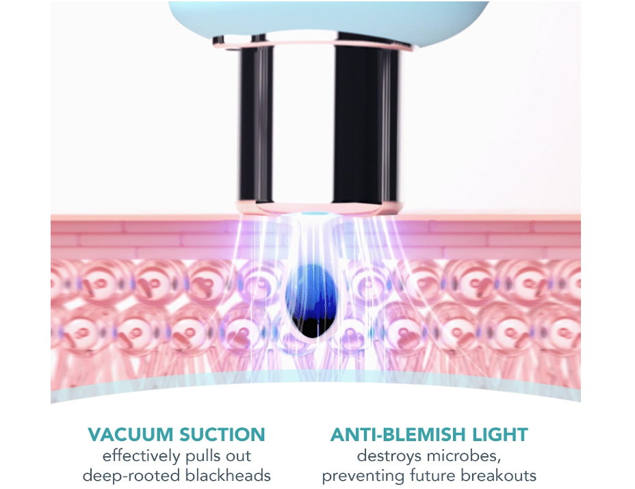 Foreo Blackhead Removal Vacuum