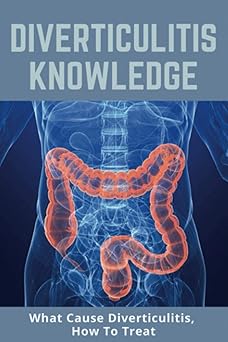 DIVERTICULITIS Knowledge: What Cause DIVERTICULITIS, How To Treat: Examples Of Low-Fiber Foods Paperback Main image