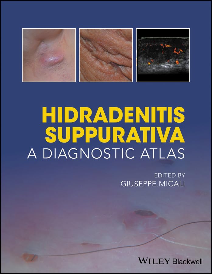 Hidradenitis Suppurativa: A Diagnostic Atlas Paperback