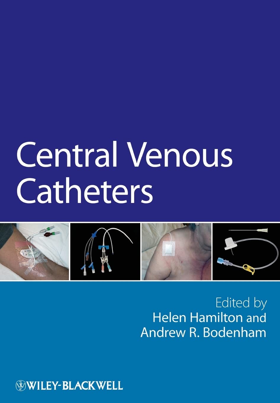 Central Venous Catheters: 26 Paperback Main image