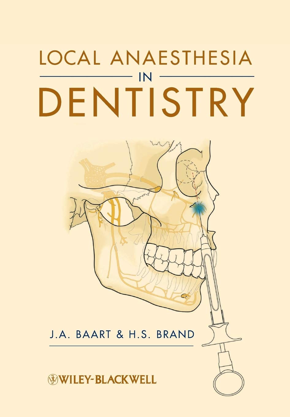 Local Anaesthesia in Dentistry Paperback Main image